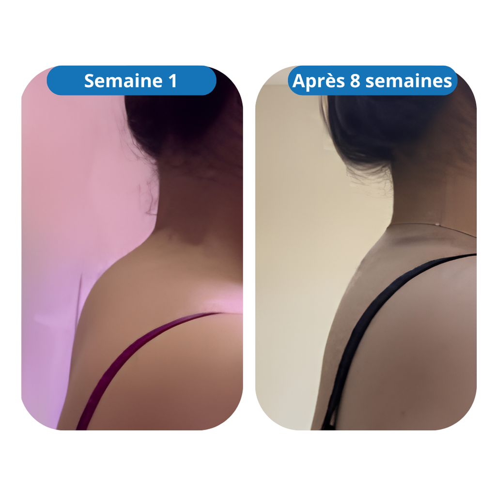 Port de Reine │  Relâche la nuque & redresse la posture