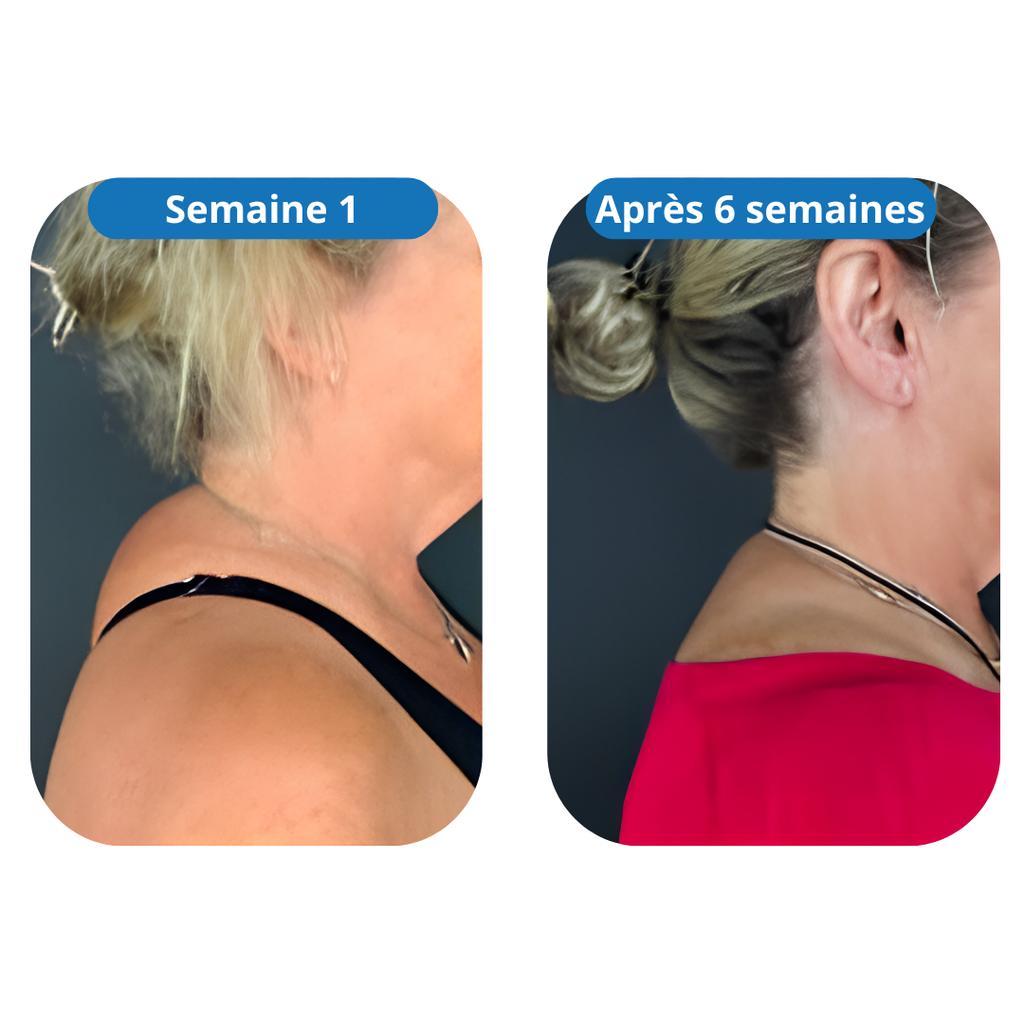Port de Reine │  Relâche la nuque & redresse la posture